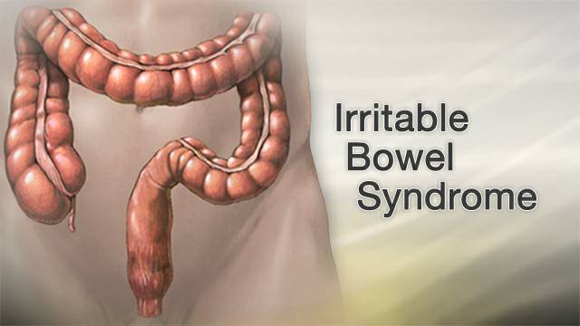 Best IBS Treatment