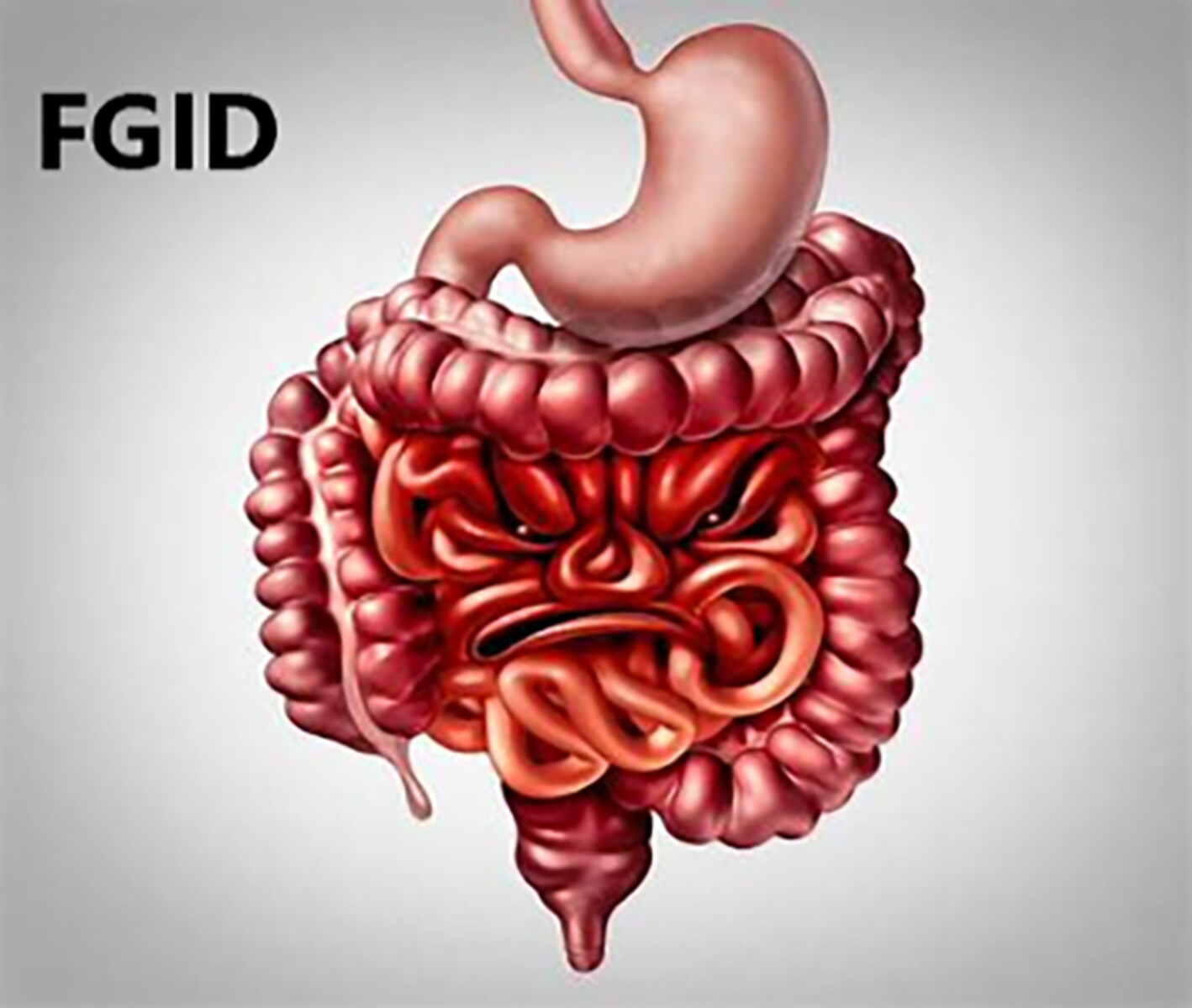 Best Functional GI Disorders Treatment